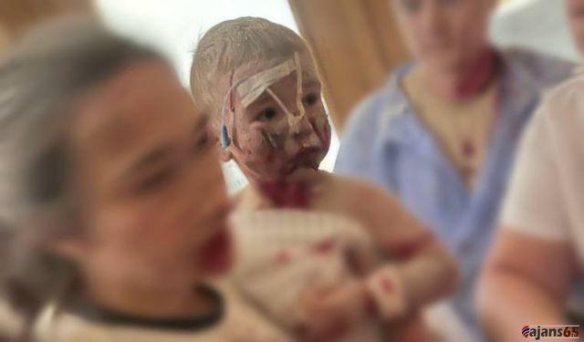Kiev’deki Saldırılarda Çocuk Hastanesi Vuruldu: 29 Ölü, 50’den Fazla Yaralı